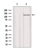 c-Cbl Antibody in Western Blot (WB)