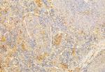 PI3K p85/p55 Antibody in Immunohistochemistry (Paraffin) (IHC (P))