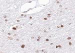 BRCA1 Antibody in Immunohistochemistry (Paraffin) (IHC (P))