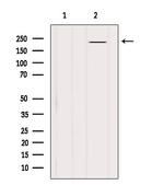 BRCA1 Antibody in Western Blot (WB)