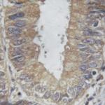 PLA2G4A Antibody in Immunohistochemistry (Paraffin) (IHC (P))