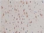 GSK3 alpha/beta Antibody in Immunohistochemistry (Paraffin) (IHC (P))