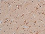 GSK3 alpha/beta Antibody in Immunohistochemistry (Paraffin) (IHC (P))