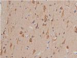 GSK3 alpha/beta Antibody in Immunohistochemistry (Paraffin) (IHC (P))