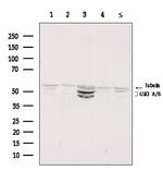 GSK3 alpha/beta Antibody in Western Blot (WB)