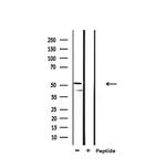 GSK3 alpha/beta Antibody in Western Blot (WB)