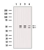 GSK3 alpha/beta Antibody in Western Blot (WB)