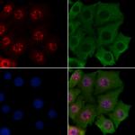 Ataxin 1 Antibody in Immunocytochemistry (ICC/IF)