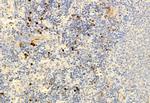 SMAD2/SMAD3 Antibody in Immunohistochemistry (Paraffin) (IHC (P))