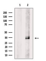 CDK5 Antibody in Western Blot (WB)