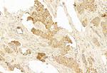 MEK1/MEK2 Antibody in Immunohistochemistry (Paraffin) (IHC (P))