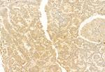 MEK1/MEK2 Antibody in Immunohistochemistry (Paraffin) (IHC (P))