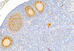 Acetyl-CoA Carboxylase Antibody in Immunohistochemistry (Paraffin) (IHC (P))