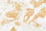 Acetyl-CoA Carboxylase Antibody in Immunohistochemistry (Paraffin) (IHC (P))