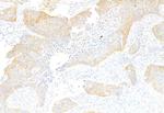 Acetyl-CoA Carboxylase Antibody in Immunohistochemistry (Paraffin) (IHC (P))