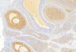 Acetyl-CoA Carboxylase Antibody in Immunohistochemistry (Paraffin) (IHC (P))