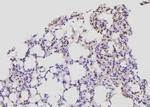 Acetyl-CoA Carboxylase Antibody in Immunohistochemistry (Paraffin) (IHC (P))