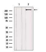 Acetyl-CoA Carboxylase Antibody in Western Blot (WB)