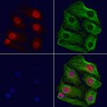 BIK Antibody in Immunocytochemistry (ICC/IF)