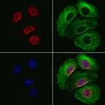 TRAP220 Antibody in Immunocytochemistry (ICC/IF)