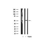 CaMKII alpha/beta/delta Antibody in Western Blot (WB)