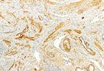 TIMP1 Antibody in Immunohistochemistry (Paraffin) (IHC (P))