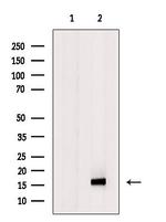 VEGFB Antibody in Western Blot (WB)