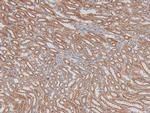 Phospho-ILK (Ser343) Antibody in Immunohistochemistry (Paraffin) (IHC (P))