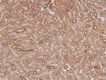 Phospho-ILK (Ser343) Antibody in Immunohistochemistry (Paraffin) (IHC (P))