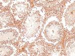 Phospho-PKC theta (Tyr90) Antibody in Immunohistochemistry (Paraffin) (IHC (P))