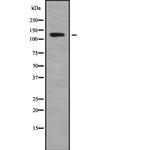 ADCY1 Antibody in Western Blot (WB)