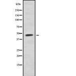 Acrosin Antibody in Western Blot (WB)