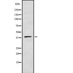 ZDHHC9 Antibody in Western Blot (WB)