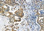 GSPT1 Antibody in Immunohistochemistry (Paraffin) (IHC (P))