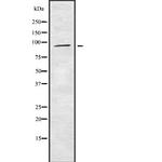 ST14 Antibody in Western Blot (WB)