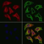 NMUR1 Antibody in Immunocytochemistry (ICC/IF)