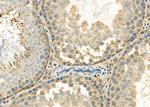 OTUB2 Antibody in Immunohistochemistry (Paraffin) (IHC (P))