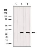 OTUB2 Antibody in Western Blot (WB)