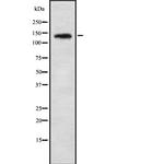 PHKA1/PHKA2 Antibody in Western Blot (WB)