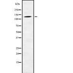 PHKB Antibody in Western Blot (WB)