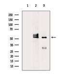 A26C2/A26C3 Antibody in Western Blot (WB)