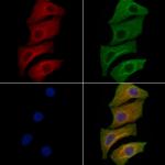 RAB34 Antibody in Immunocytochemistry (ICC/IF)