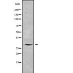 RAB34 Antibody in Western Blot (WB)