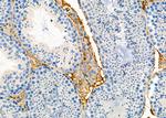 RhoG Antibody in Immunohistochemistry (Paraffin) (IHC (P))