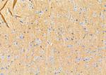 RhoG Antibody in Immunohistochemistry (Paraffin) (IHC (P))