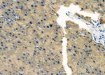 RPS2 Antibody in Immunohistochemistry (Paraffin) (IHC (P))