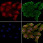 Separase Antibody in Immunocytochemistry (ICC/IF)