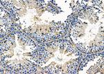 STAM2 Antibody in Immunohistochemistry (Paraffin) (IHC (P))