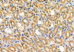 STAM2 Antibody in Immunohistochemistry (Paraffin) (IHC (P))