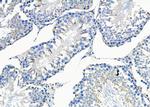 STAM2 Antibody in Immunohistochemistry (Paraffin) (IHC (P))